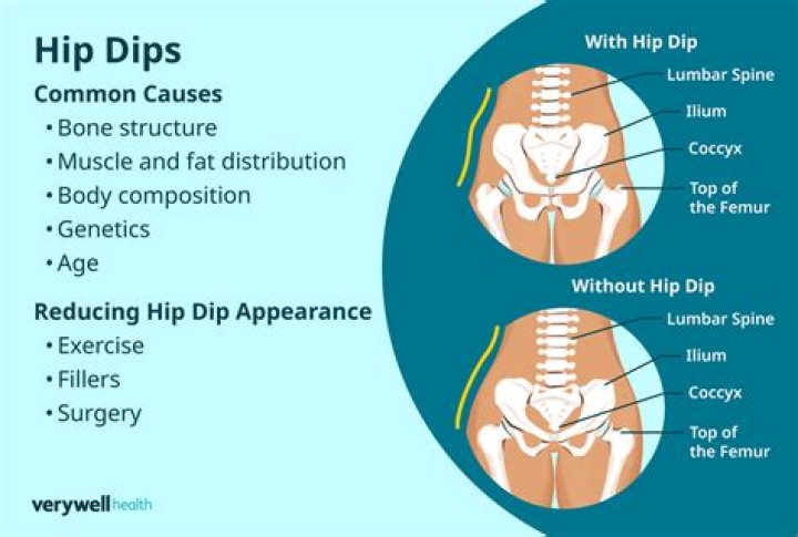 what are hip dips